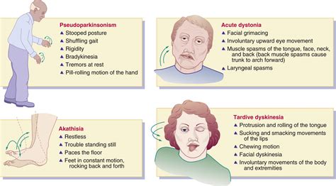 acute dystonia vs akathisia